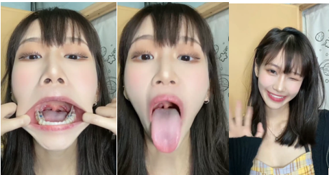 介绍系列-佳佳口腔检查+讲解9V视频【百度网盘下载】-阿黑颜