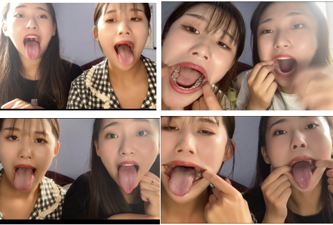2人组合口腔检查4V吐舌头视频【百度网盘下载】-阿黑颜
