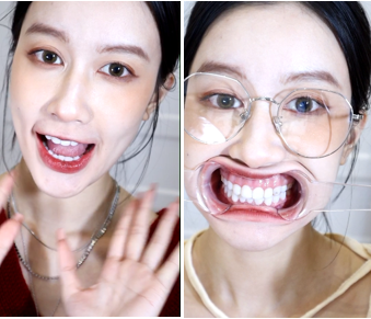 一美女模特牙齿检查过程戴开口器8V自拍视频【百度网盘下载】-阿黑颜