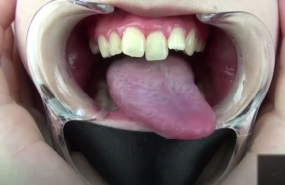 开口器美女吐恋物癖吐舌头 HD.mp4【在线观看视频】-阿黑颜