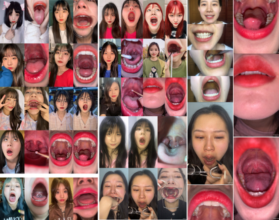 【恋物癖】精选15位美女口腔检查合集 [22V+4.65G][百度网盘下载] 最强车神专属-阿黑颜