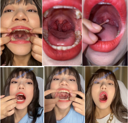 [P站/91/自拍]ஐ恋物癖ஐ超可爱抖音萌妹在线定制口腔牙齿特写极致反差【9.95G】百度网盘下载-阿黑颜